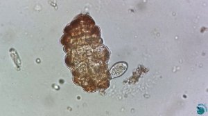 Tetrahymena напала на умирающую тихоходку!