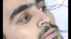 Шаҳбол Мирзоев дар беморхона