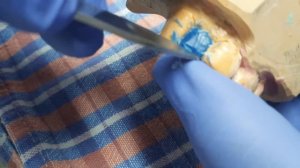 Моделировка промежуточной части мостовидного протеза под фасетку.