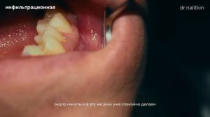 Как Правильно Делать Анестезию