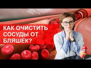 Как очистить сосуды от холестериновых бляшек?
