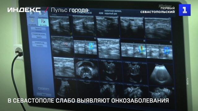 В Севастополе слабо выявляют онкозаболевания