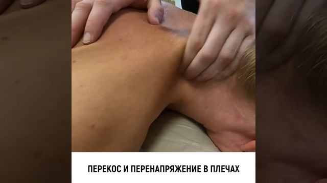 Исправление осанки с помощью мануальной терапии