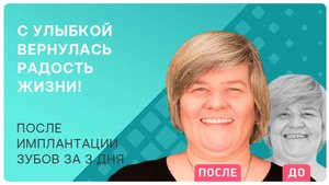 Какие ощущения во время установки имплантов и сразу после? Делюсь личным опытом!