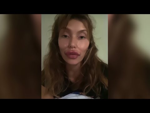 Регина Тодоренко показала разминку для красивого лица