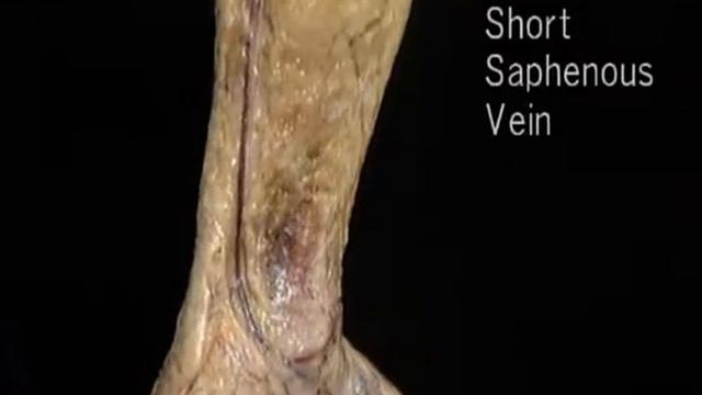 подкожные вены ноги