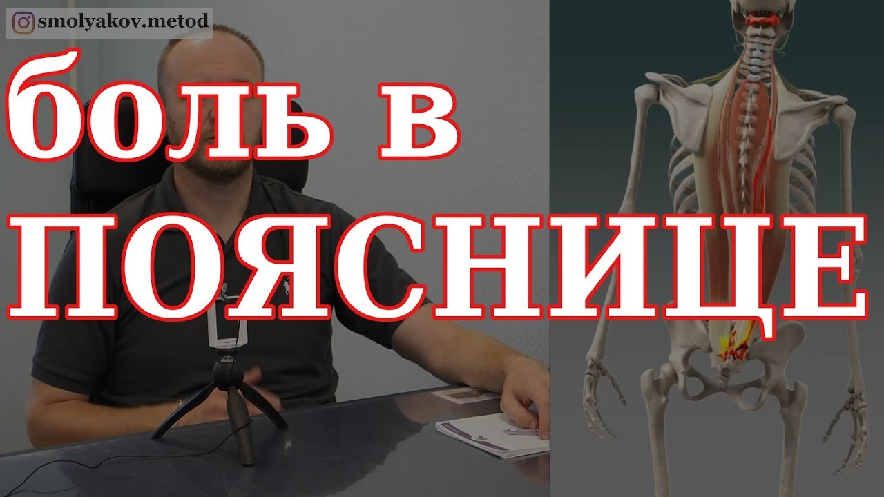 Боль в пояснице что делать. Почему болит поясница? Боль в нижней части спины.