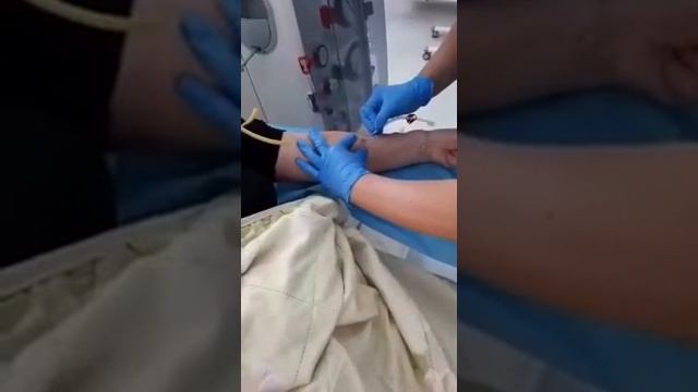 отключение и подключение к аппарату гемодиализ