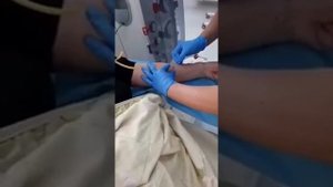 отключение и подключение к аппарату гемодиализ