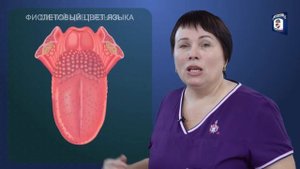 "На приеме у врача" Выпуск 57 - О чем говорит цвет языка?