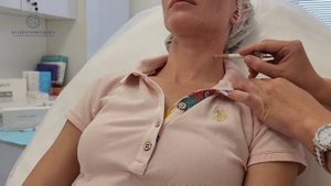 Омоложение жидкими нитями шеи (кольца венеры) Iniblanc техника введения жидких нитей