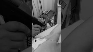 Depilação á Laser