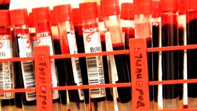 Стань донором! смотреть онлайн