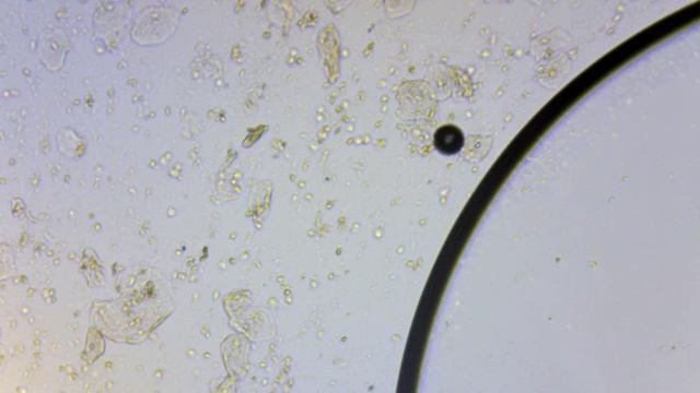 Слюна под микроскопом - CollectPhoto.ru