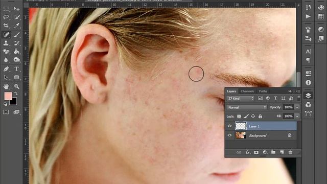 power of spot healing brush tool Photoshop remove pimple tutorial смотреть онлайн