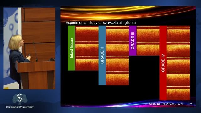 II Сеченовский Международный Биомедицинский Саммит-2018 (SIBS-2018) смотреть онлайн