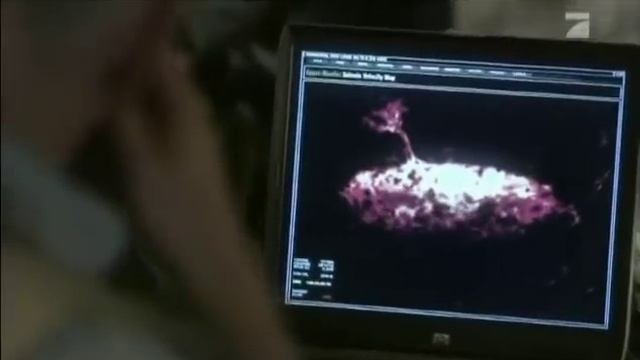 Supervulkan