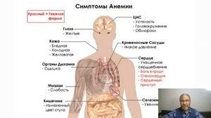 Хиджама. Головные боли.