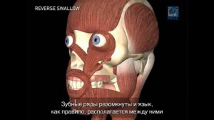 Реверсивный тип глотания