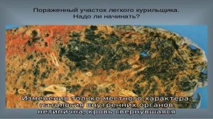 Профилактика эмфизематозного карбункула