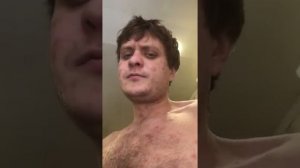 Ветрянка у детей и взрослых