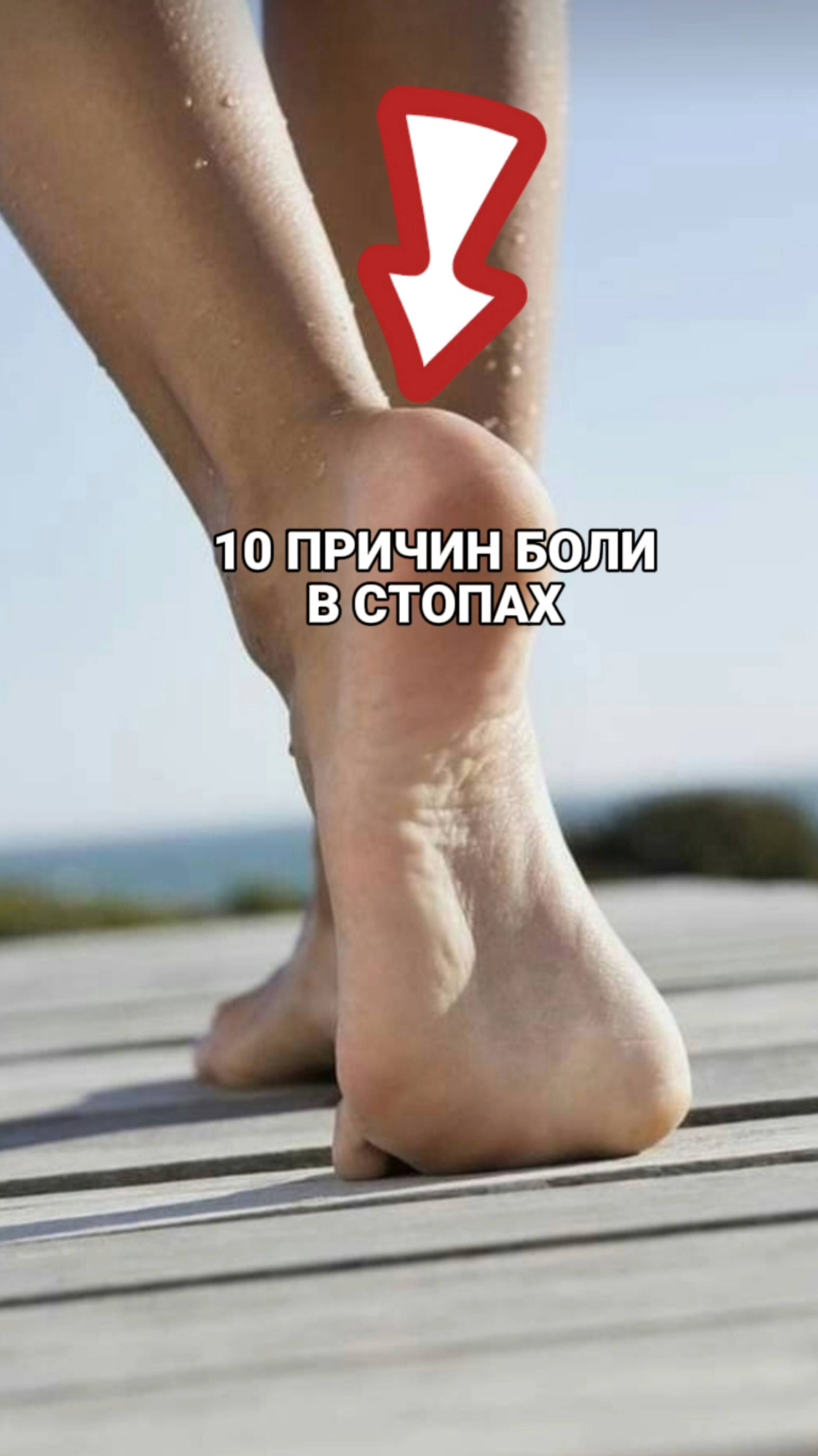 10 ПРИЧИН БОЛИ В СТОПЕ. #ортопедмосква #больвстопе #пяточнаяшпора #бурсит #стопа #стельки