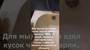 Как купаться с аппаратом Илизарова