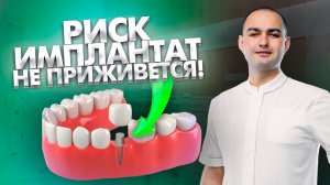 Насколько высок риск неприживления дентального имплантата? Стоматология. Стоматолог. Лечение зубов.