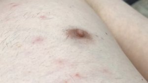 Как проучить мужа) или лазерная эпиляция мужской груди