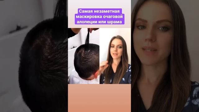 Такие мужские системы волос уже есть в России) Более подробно - в описании канала? смотреть онлайн