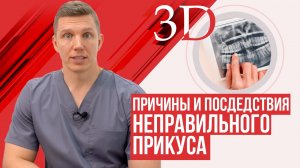 Неправильный прикус. Причины и последствия