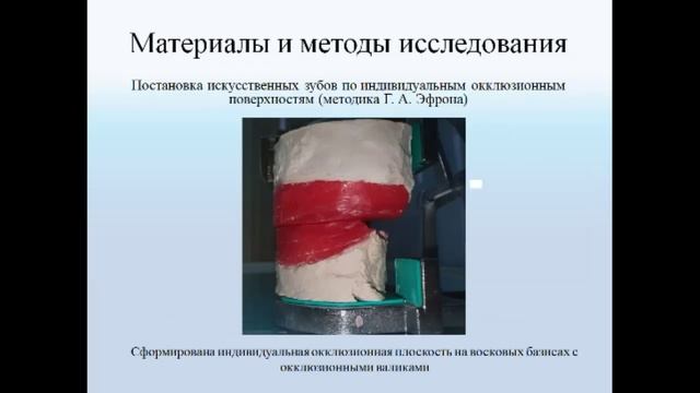 Современные методы формирования окклюзионных кривых на этапах изготовления съемных протезов