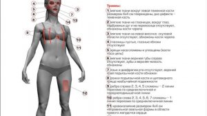Группа Дятлова. Криминальные следы воздействия