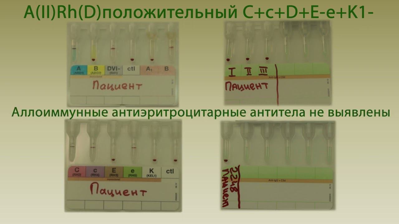 Проведение индивидуального подбора