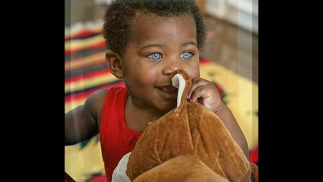 три цвета моих глаз -- гипертрихоз смотреть онлайн