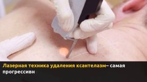 Удаление ксантелазм