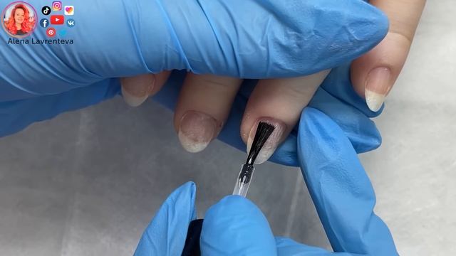 Загноился заусенец / Панариций последствия ? смотреть онлайн