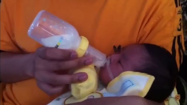 Daania using Medela SpecialNeeds® Feeder