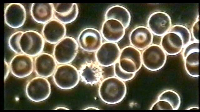 Campo Oscuro - Videomicroscopia 02 Dopo смотреть онлайн