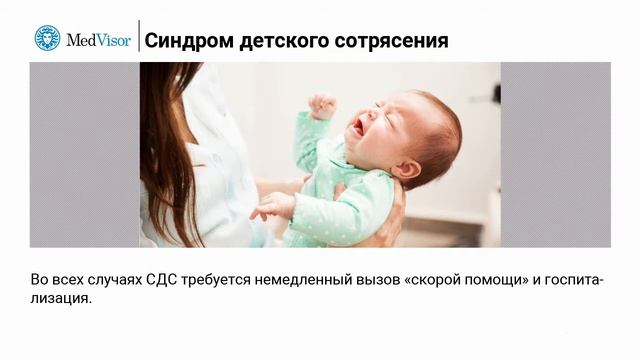 Синдром детского сотрясения