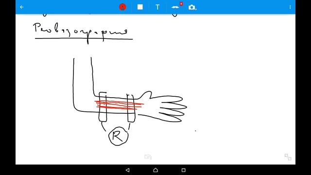 Методы исследования сосудов. Пульс и реовазография смотреть онлайн