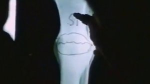 Кремний  ДокФильм СССР. Удивительные свойства и польза для организма.