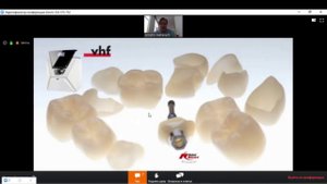 Интраоральное сканирование. #3Sahpe #Trios // Правила. Принципы. Хитрости и приёмы.