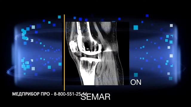 Canon Aquilion ONE - спиральный КТ смотреть онлайн
