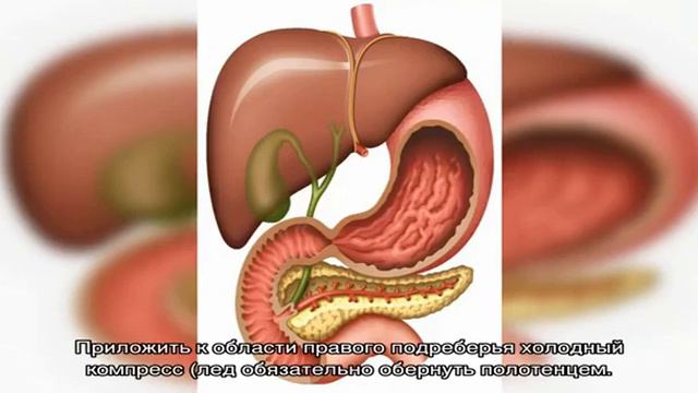 Как снять боль желчного пузыря в домашних условиях