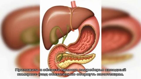 Как снять боль желчного пузыря в домашних условиях