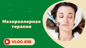 #35 Мезороллеры - это серьёзно или нет? Все за и против. Мнение косметолога.
