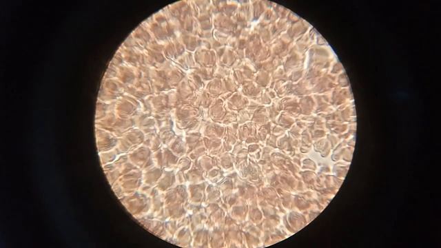 Как изменится кровь после молока. Большой эксперимент смотреть онлайн