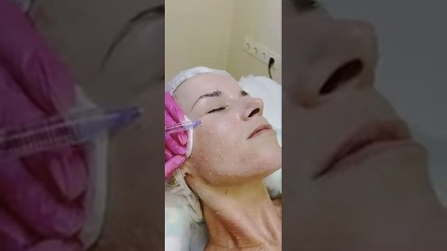 Видео семинар для косметологов