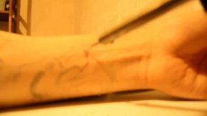 Как быстро удалить татуировку ?